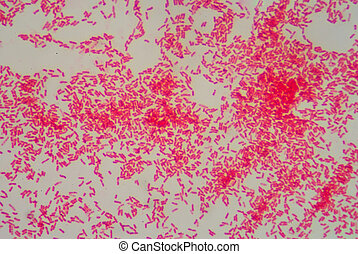 Microbacterium Stock Photo Images. 19 Microbacterium royalty free ...